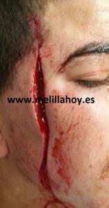 melillahoy.cibeles.net fotos 1623 suceso