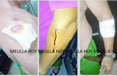 melillahoy.cibeles.net fotos 1705 agredidos ciclistas Beni Enzar Nador dd