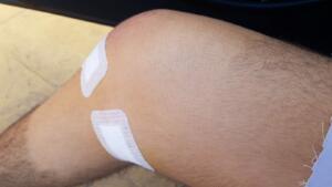Los hermanos también acusan al linier de haberles agredido y muestran igualmente fotos de lesiones