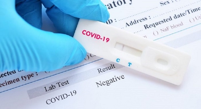 Imagen del test del coronavirus