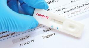 Imagen de un test de Covid 19