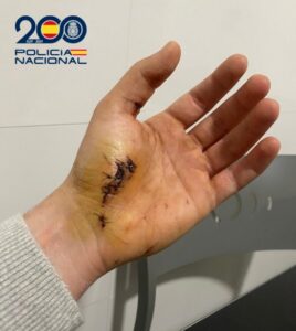 Policía herido después de la atención médica