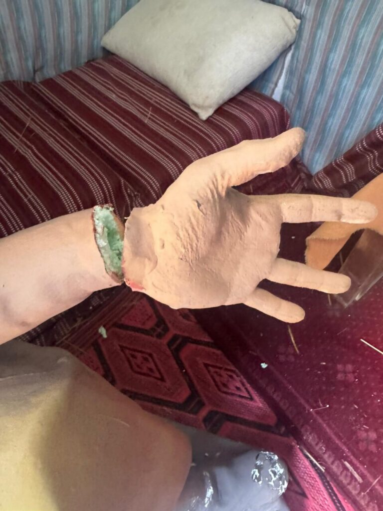 Mano de figura del Belén monumental dañada por vandalismo