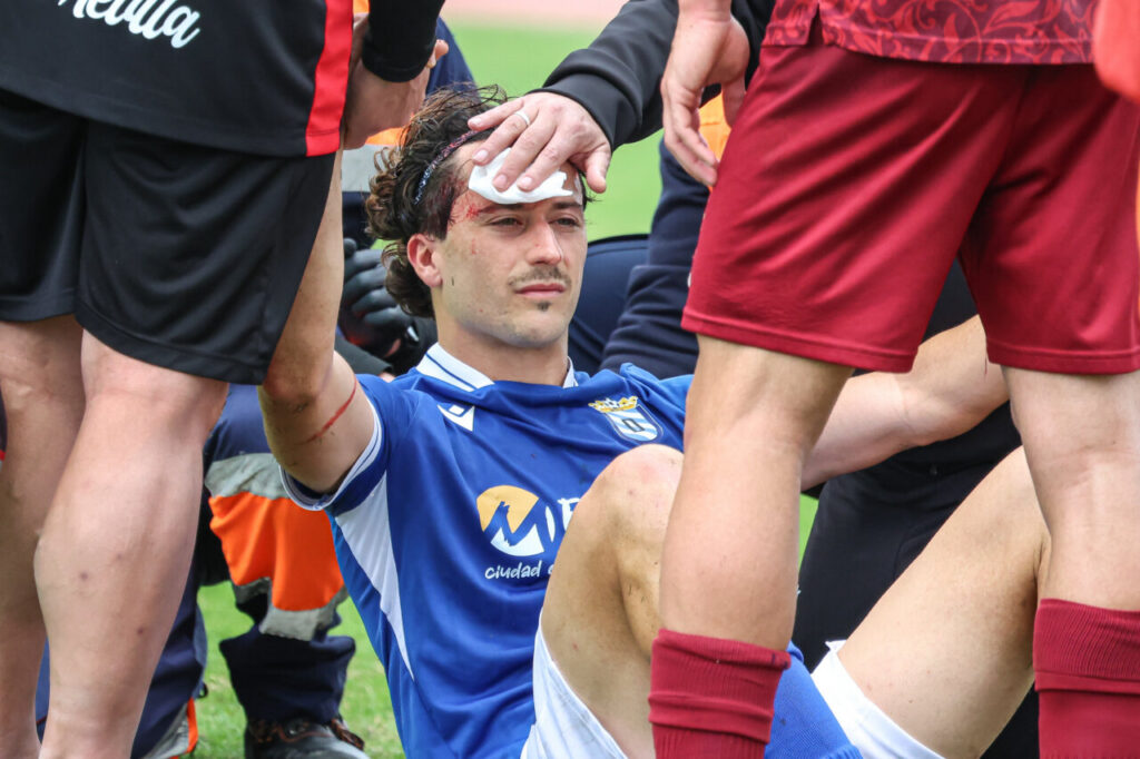 Jugador de la U.D. Melilla siendo atendido tras un golpe en la cabeza